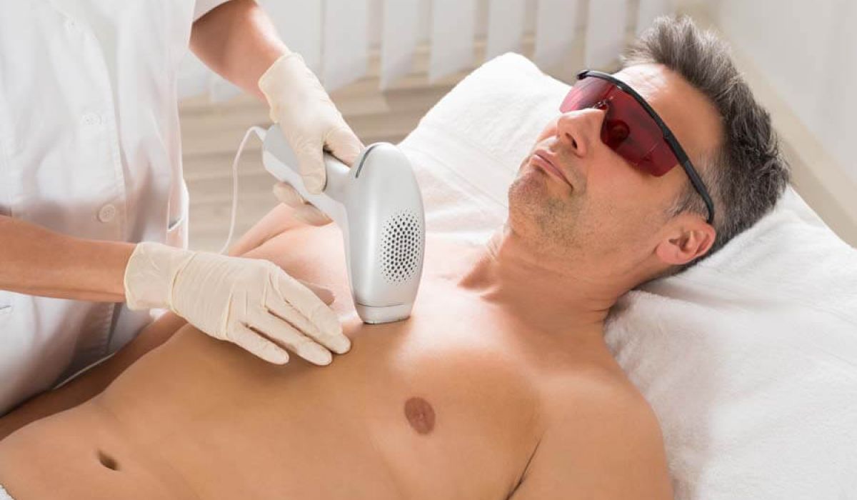 A man receiving IPL Hair Removal